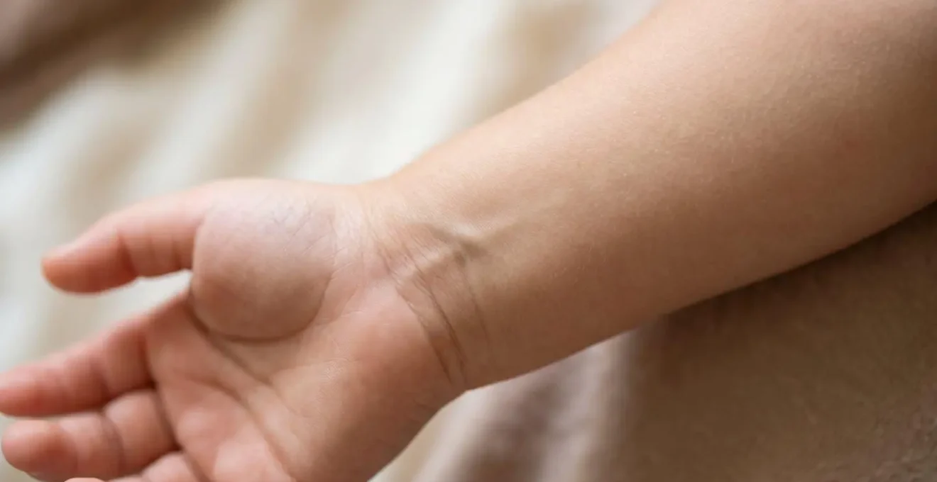 Nei-Kuan-Akupressurpunkt am Handgelenk zur Linderung von Reiseübelkeit bei Kindern